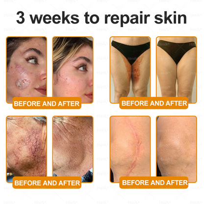 𝑯𝙞𝒎𝙞𝙡𝒌® ---Only 10 jars! Grab an exclusive 30% discount now! Keep your skin youthful and glowing in just 1 to 3 weeks. Don’t miss your chance—this offer won’t come around again until next year. Act fast! 180-day money back guarantee!🔥