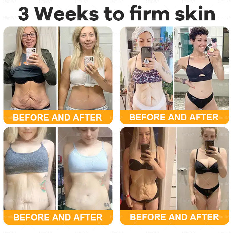 𝑯𝙞𝒎𝙞𝙡𝒌® ---Only 10 jars! Grab an exclusive 30% discount now! Keep your skin youthful and glowing in just 1 to 3 weeks. Don’t miss your chance—this offer won’t come around again until next year. Act fast! 180-day money back guarantee!🔥