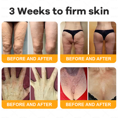 𝑯𝙞𝒎𝙞𝙡𝒌® ---Only 10 jars! Grab an exclusive 30% discount now! Keep your skin youthful and glowing in just 1 to 3 weeks. Don’t miss your chance—this offer won’t come around again until next year. Act fast! 180-day money back guarantee!🔥