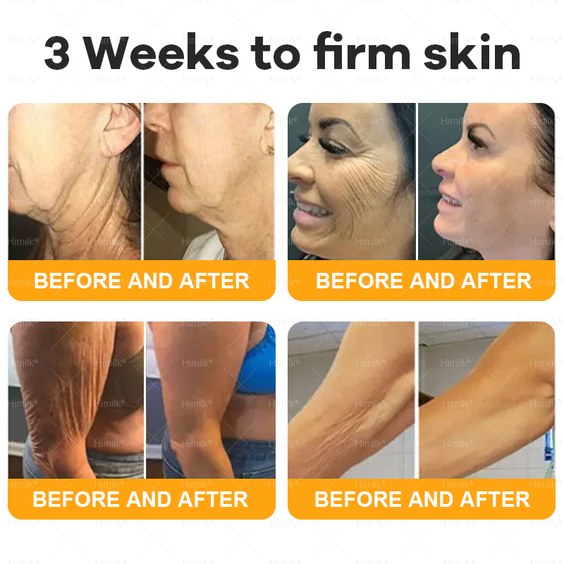 𝑯𝙞𝒎𝙞𝙡𝒌® ---Only 10 jars! Grab an exclusive 30% discount now! Keep your skin youthful and glowing in just 1 to 3 weeks. Don’t miss your chance—this offer won’t come around again until next year. Act fast! 180-day money back guarantee!🔥