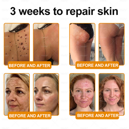 𝑯𝙞𝒎𝙞𝙡𝒌® ---Only 10 jars! Grab an exclusive 30% discount now! Keep your skin youthful and glowing in just 1 to 3 weeks. Don’t miss your chance—this offer won’t come around again until next year. Act fast! 180-day money back guarantee!🔥